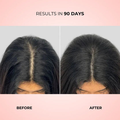 Revela Follicle Boost™ - Revela