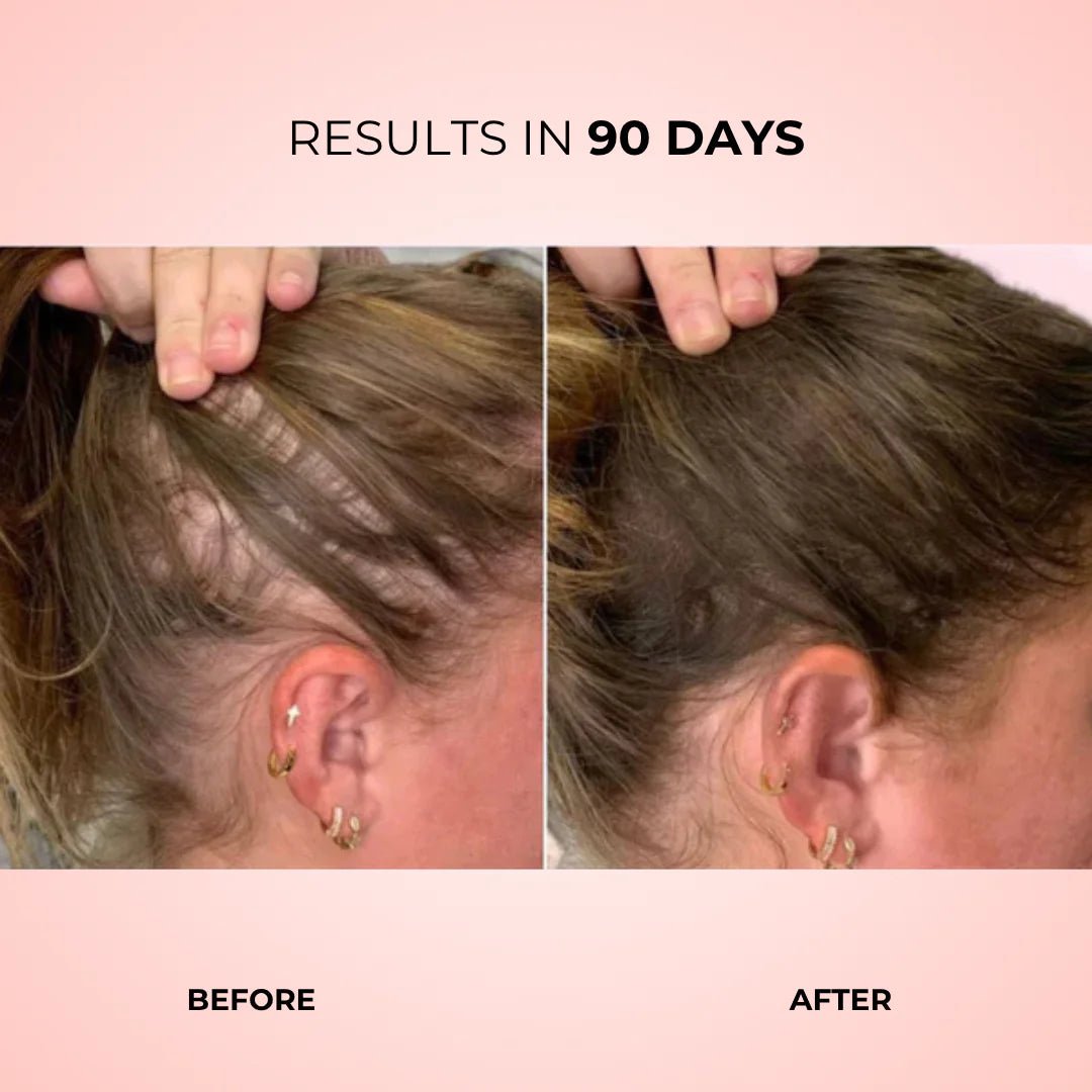 Revela Follicle Boost™ - Revela