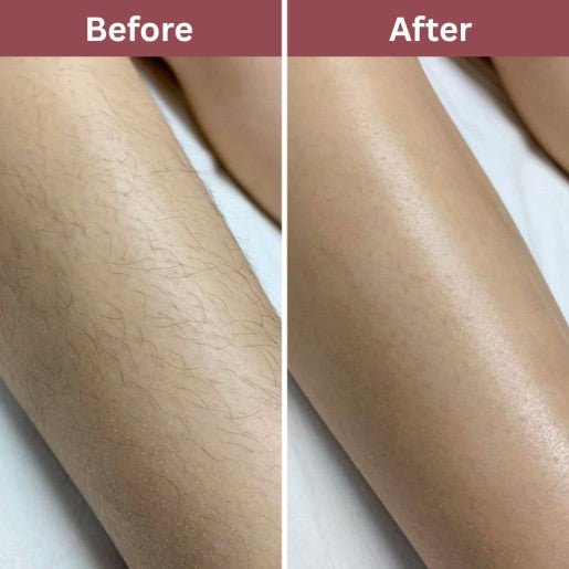 Revela Hair Trimmer - Revela